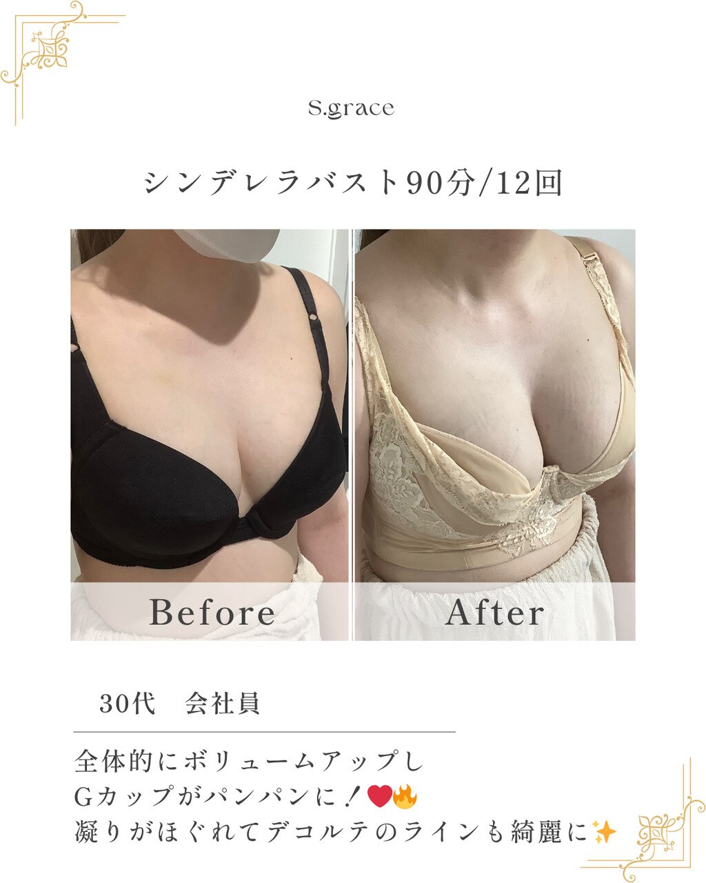 肩凝りとデコルテの骨ぼねしさ、実は関係していた!