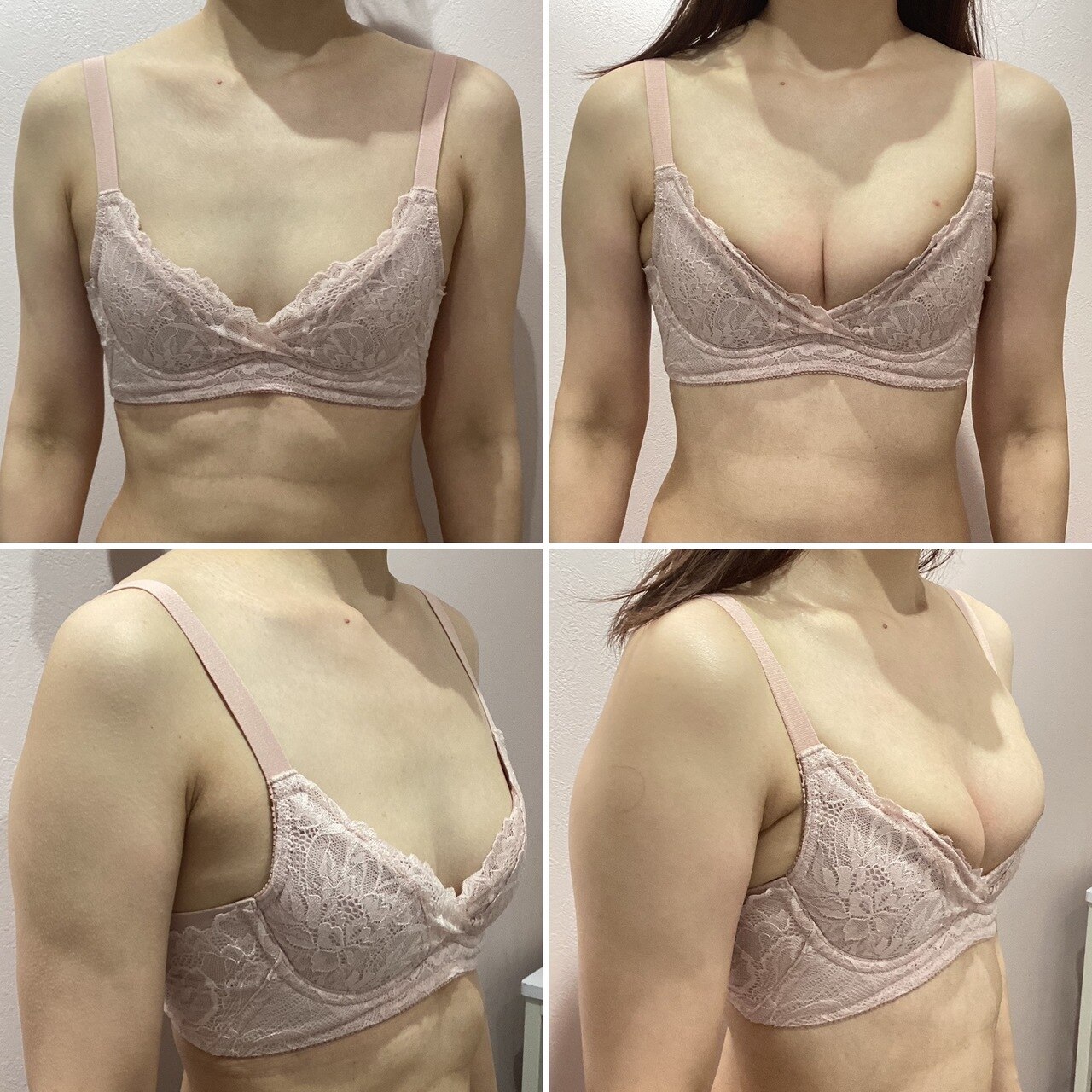 30代からのバストケアまだまだ間に合います。