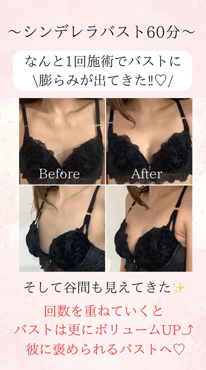 比べて落ち込む前に。ちゃんと育つバストサロン
