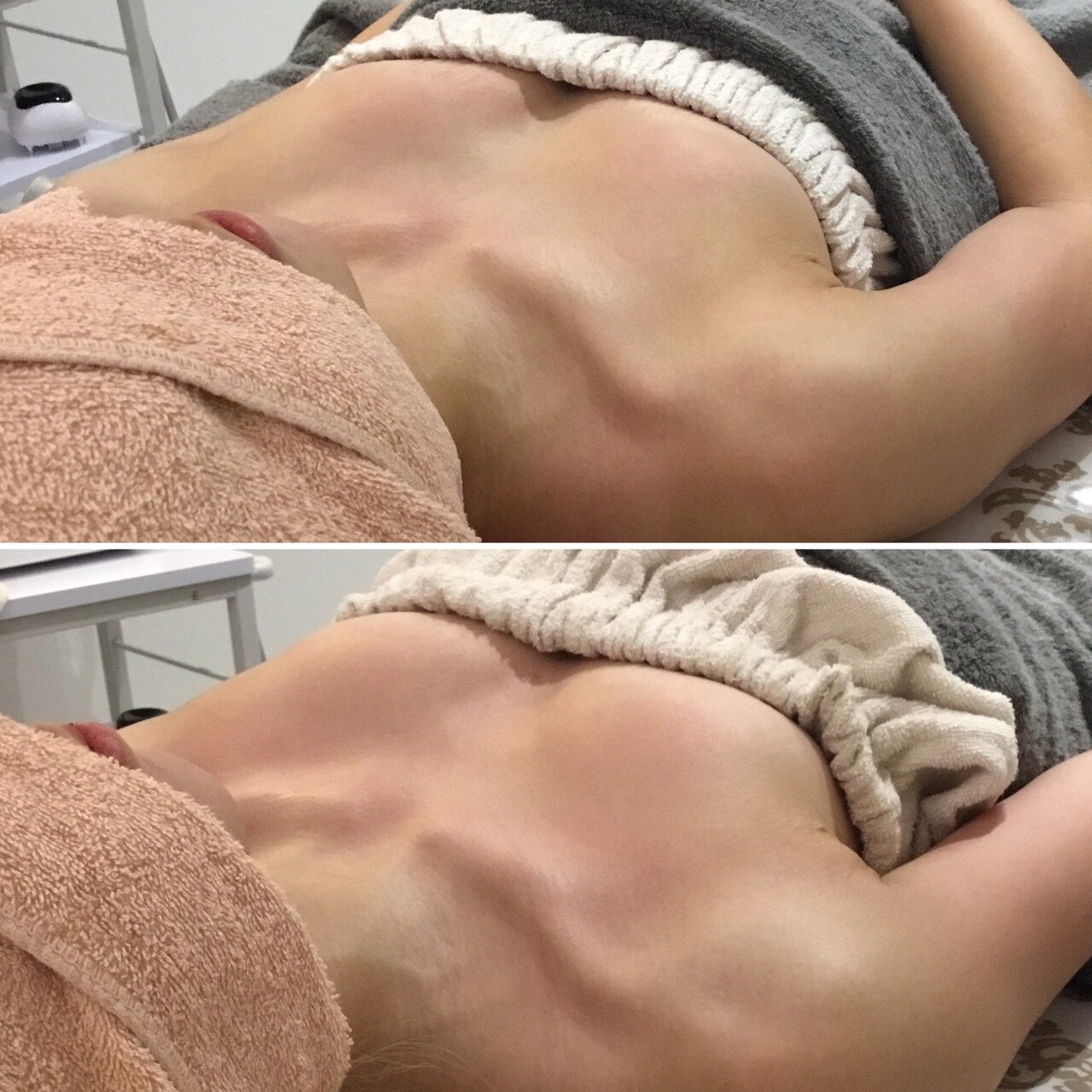授乳後の“ふにゃふにゃバスト”に終止符。