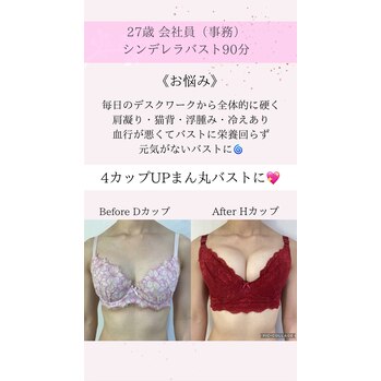 豊胸級!!!Before,After