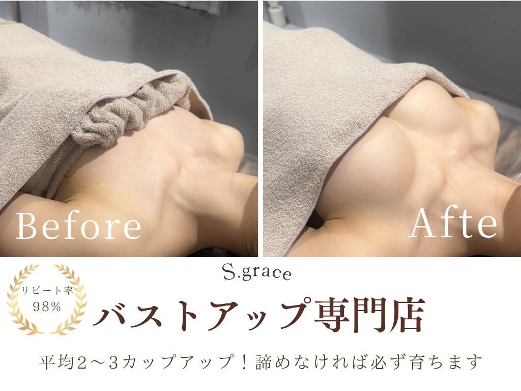薄着になる前に始める上半身ラインを整えるバストケア