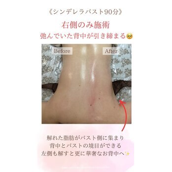 肩こりと貧乳は比例する?!
