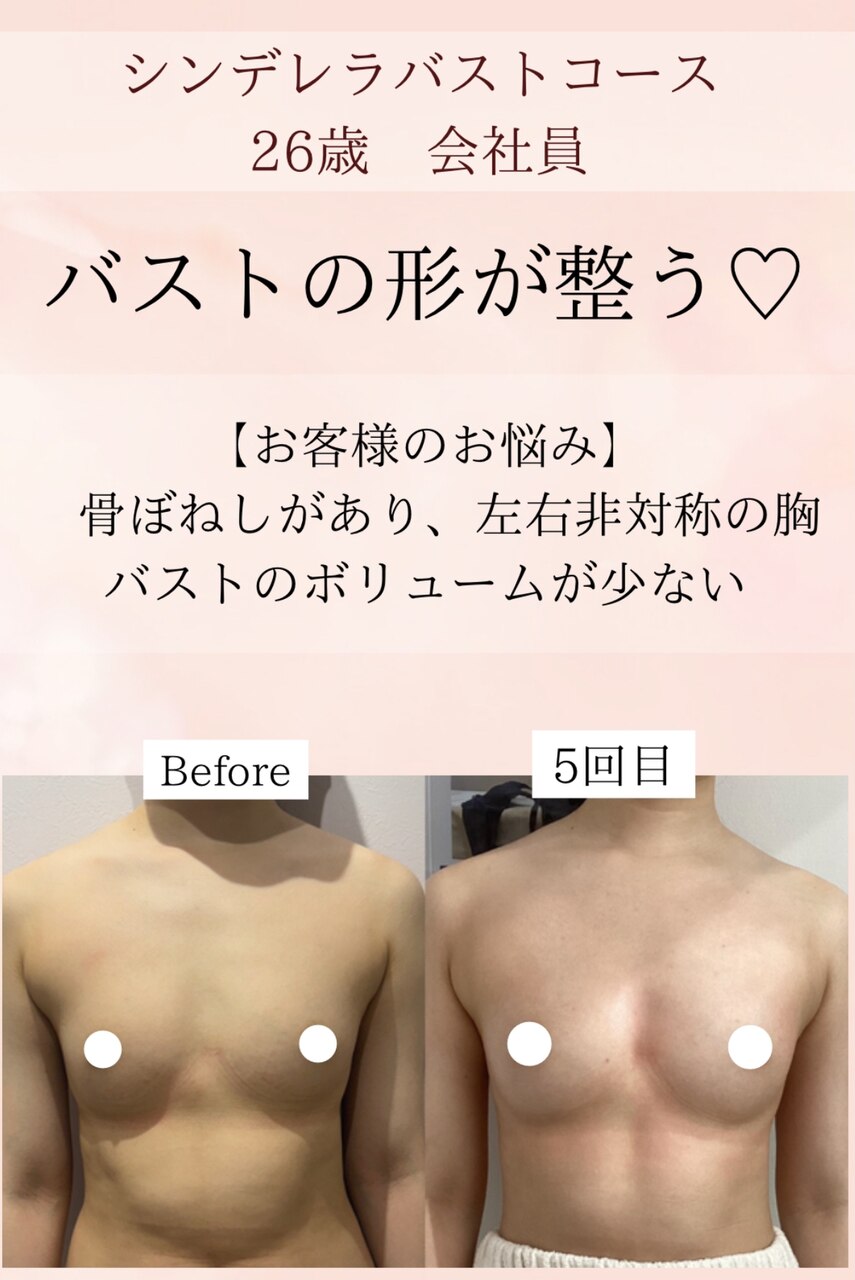 離れたバストも元の本来の位置へ戻す