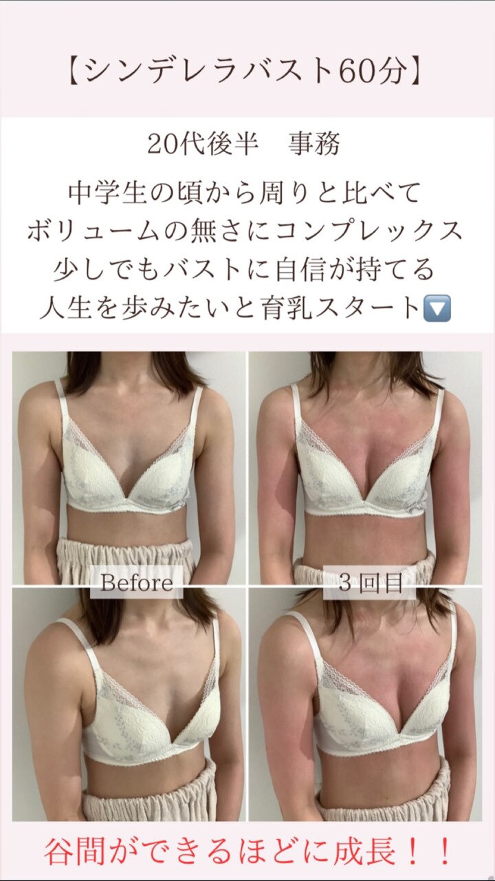 学生の頃から胸がコンプレックスで悩んでいたお客様!