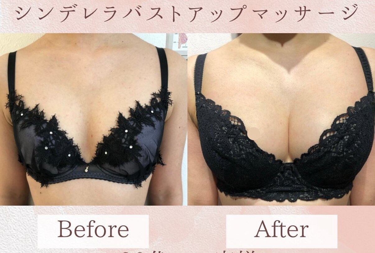 自己流では変わらなかった方は受けてほしいバストケア