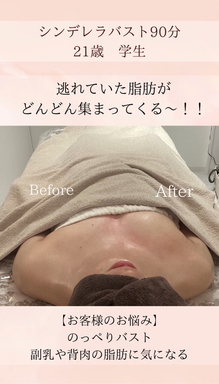 胸の上らデコルテが寂しく見える方のバストケア方法!