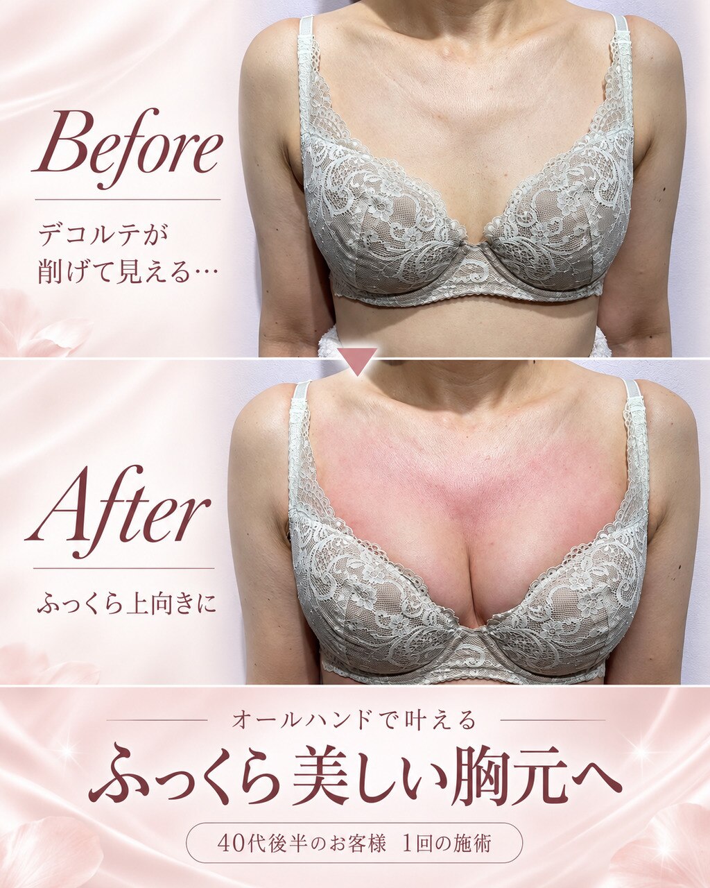 胸が下がって見える原因は?