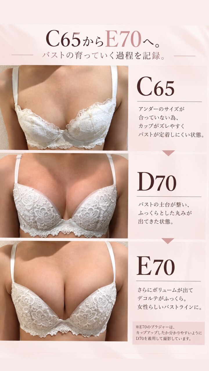 本当に胸は育つ?C65→E70へ|バストアップ症例!!
